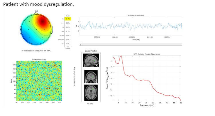 What are brain maps? | Foothills Integrative
