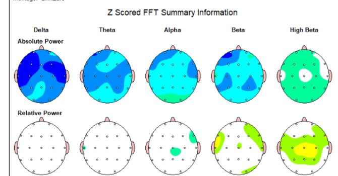 What is Concussion, It’s symptoms & treatment image